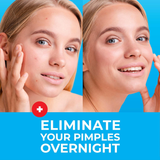 NEW Patchrx Pimple Patches for Face (120 Patches), Hydrocolloid Acne Patches with Tea