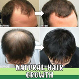 NEW 7 Day Herb Germinal Serum Organic Hair Regrowth Kit Ginger Anti-Hair Loss, Extract natural ginger ingredients