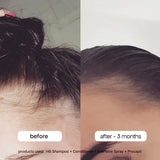 NEW Sephora BondiBoost Intensive Daily Scalp Spray for Thinning Hair with Rosemary