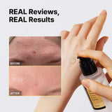 NEW Advanced Snail 96 Mucin Power Essence! Hydrates, Brightens, Smoothes Skin, Reduces appearance of dark spots and Aging!