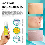 Lumanere Razor Bumps Solution for Ingrown Hair, Hair Inhibitor – After Shave Serum, Roll-on for Bikini Area, Legs and Underarm Area for Men and Women