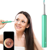 New in box! BEBIRD | Ear Cleaner Camera Tool | iPhone Android! Check ear canal and clean earwax, help your family member do ear exam, but also check ear for your dog, cat with the alcohol sterilization. It is also suitable for skin, teeth examination.