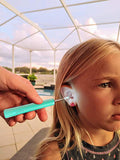 New in box! BEBIRD | Ear Cleaner Camera Tool | iPhone Android! Check ear canal and clean earwax, help your family member do ear exam, but also check ear for your dog, cat with the alcohol sterilization. It is also suitable for skin, teeth examination.