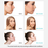 New in box! Blackhead Remover Pore Vacuum, Xpreen Pore Cleaner Rechargeable Comedone Suction Removal Tool for Facial Pore Cleanser, Beauty Device with LED Screen